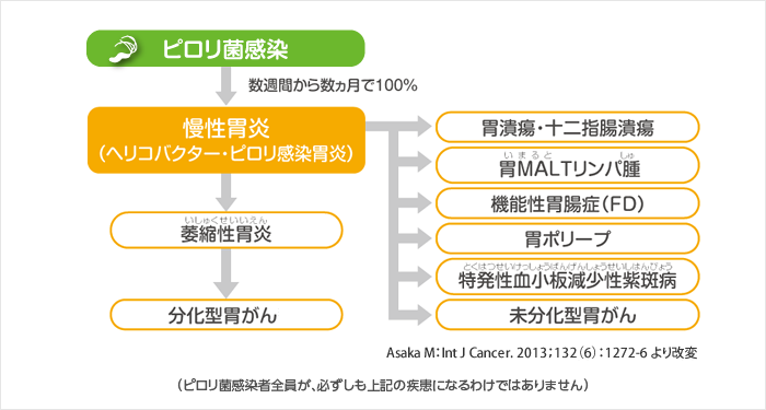 ピロリ菌感染